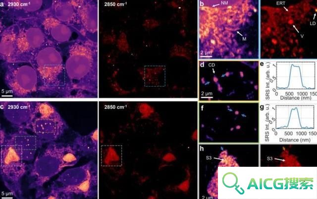 科学家用AI开发受激拉曼纳米成像技术，分辨率可达86纳米